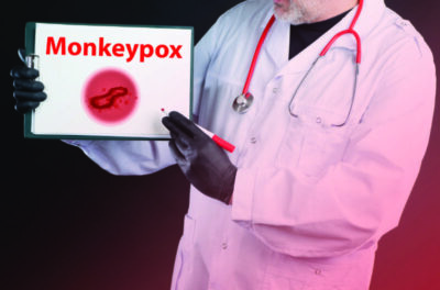 Monkeypox